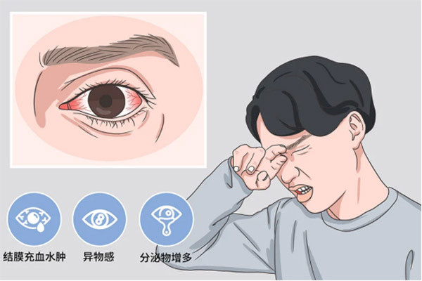次氯酸治療細菌性和病毒性結膜炎